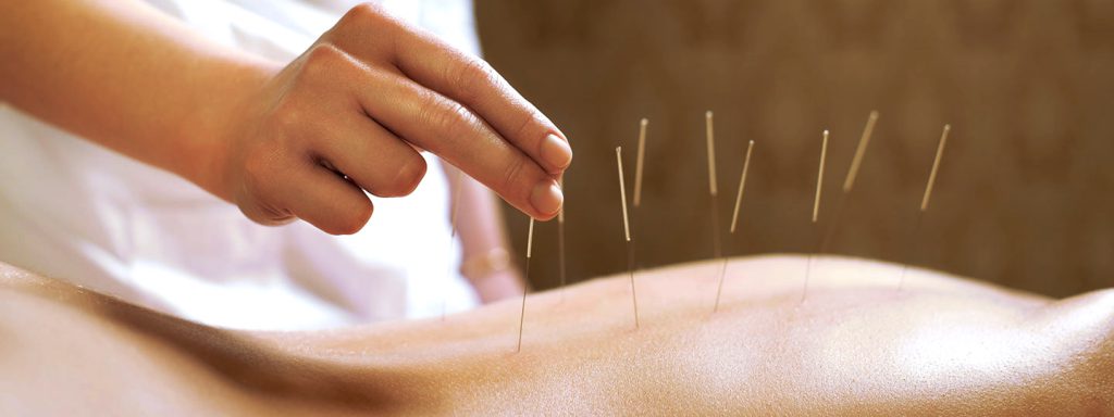 TCM Akupunktur
